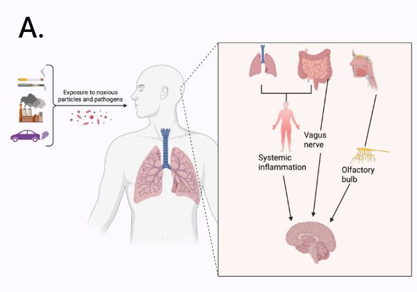 A Schematic shows environmental pollution and PD mechanisms. (A) Inhaled and ingested pollutants enter the body through the respiratory and gastrointestinal systems and reach the brain via the vagus nerve, olfactory pathways, and blood (B).