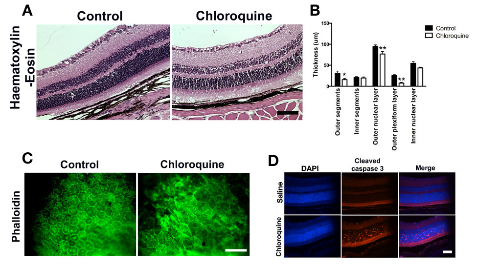 Transmission electron micrographs showed chloroquine-induced damage of the outer nuclear layer. Transmission EM images of chloroquine-treated eyes (B-D) showed morphological changes compared to control eyes (A).