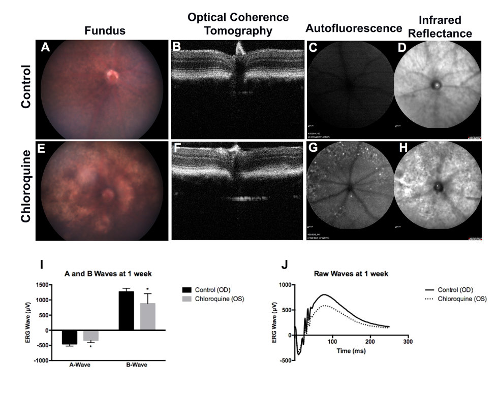 Chloroquine alters retinal layer thicknesses and activates caspase-3. (A) Hematoxylin and eosin staining of paraffin-embedded retinal cross sections showed altered outer retina thickness following 1-week post-CQ injection.