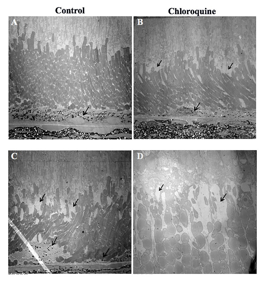 Isolated RPE and neurosensory retina showed gene expression consistent with cell death activation. Analysis via q-PCR indicates that CQ toxicity induces cell death and up regulation of cell death markers, Cathepsins, and antioxidant genes.
